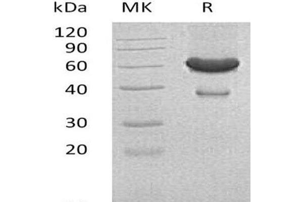Ephrin A1 Protein (EFNA1) (His tag,Fc Tag)