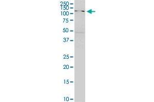 SKIV2L monoclonal antibody (M05), clone 1E5. (SKIV2L antibody  (AA 1125-1233))