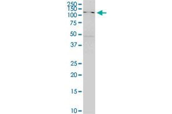 SKIV2L antibody  (AA 1125-1233)