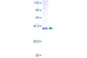 CKAP2 Protein (AA 1-161) (GST tag)