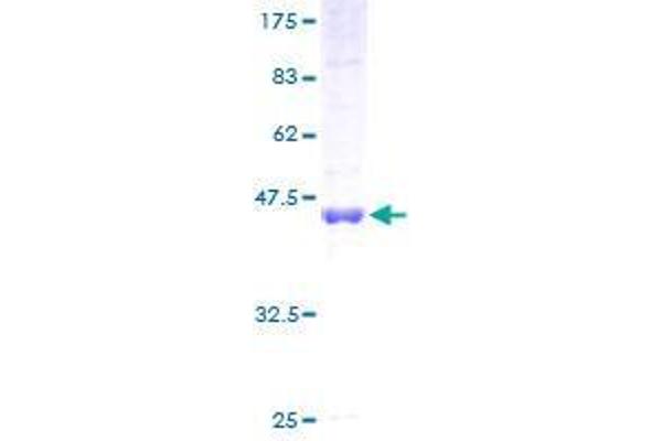 CKAP2 Protein (AA 1-161) (GST tag)