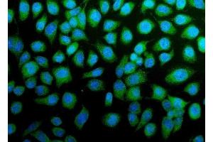 anti-Cadherin 13 (CDH13) (AA 149-692) antibody