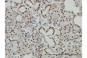 Immunoperoxidase of monoclonal antibody to EP300 on formalin-fixed paraffin-embedded human salivary gland. (p300 antibody  (AA 731-830))