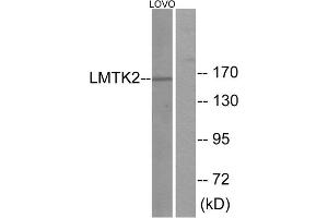 Western blot analysis of extracts from LOVO cells, using LMTK2 antibody. (LMTK2 antibody  (Internal Region))