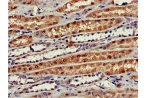Immunohistochemistry of paraffin-embedded human kidney tissue using ABIN7163262 at dilution of 1:100 (PHOSPHO1 antibody  (AA 1-267))