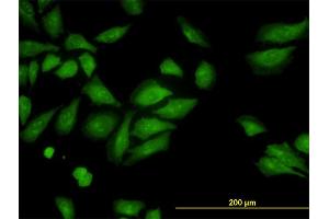 Immunofluorescence of monoclonal antibody to ROCK2 on HeLa cell.