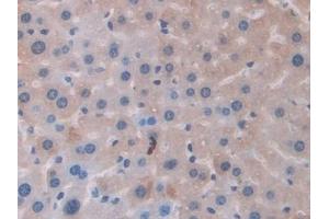 Detection of FTMT in Mouse Liver Tissue using Polyclonal Antibody to Ferritin, Mitochondrial (FTMT) (Ferritin Mitochondrial antibody  (AA 54-229))