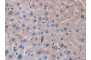 Detection of FTMT in Mouse Liver Tissue using Polyclonal Antibody to Ferritin, Mitochondrial (FTMT)