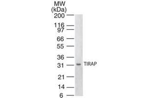Western blot analysis of TIRAP. (TIRAP antibody)
