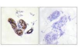 Immunohistochemistry analysis of paraffin-embedded human skin tissue using MITF (Ab-180/73) antibody. (MITF antibody  (Ser73, Ser180))