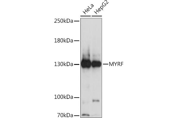 Chromosome 11open Reading Frame 9 (C11orf9) (AA 1-100) Antikörper