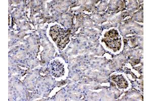 Immunohistochemistry (IHC) image for anti-Laminin, gamma 1 (LAMC1) (all Isoforms) antibody (ABIN5692889)