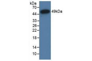 Western Blot; Sample: Recombinant NR3C1, Human. (Glucocorticoid Receptor antibody  (AA 598-755))