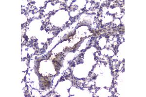 Immunohistochemistry (IHC) image for anti-phosphodiesterase 4D, cAMP-Specific (PDE4D) (AA 466-709) antibody (ABIN5693278)
