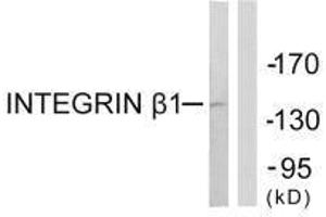 Western blot analysis of extracts from Jurkat cells, using Integrin β1 (Ab-789) antibody. (ITGB1 antibody  (Thr789))
