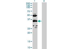 Western Blot analysis of CCBL1 expression in transfected 293T cell line by CCBL1 MaxPab polyclonal antibody. (CCBL1 antibody  (AA 1-374))