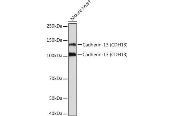 Cadherin 13 antibody