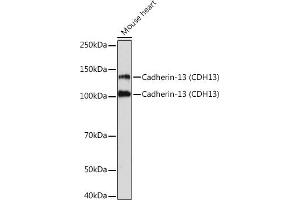 Western blot analysis of extracts of Mouse heart, using Cadherin-13 (CDH13) Rabbit mAb (ABIN7265996) at 1:1000 dilution. (Cadherin 13 antibody)