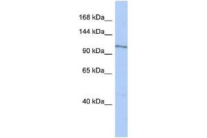 WB Suggested Anti-MAP4K4 Antibody Titration:  0. (MAP4K4 antibody  (N-Term))