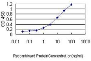 Detection limit for recombinant GST tagged USF1 is approximately 0. (USF1 antibody  (AA 1-310))