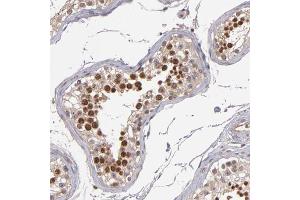 Immunohistochemical staining of human testis with ABHD12B polyclonal antibody  shows strong nuclear positivity in cells of seminiferus ducts at 1:200-1:500 dilution. (ABHD12B antibody)