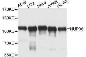 Western blot analysis of extracts of various cell lines, using NUP98 antibody (ABIN5970195) at 1/1000 dilution.