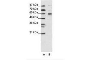 Image no. 1 for anti-General Transcription Factor IIF, Polypeptide 1, 74kDa (GTF2F1) (N-Term) antibody (ABIN6736098) (GTF2F1 antibody  (N-Term))