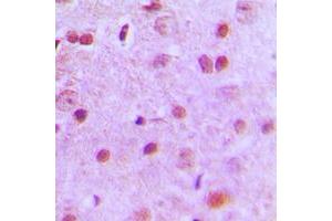 Immunohistochemical analysis of NFYA staining in human brain formalin fixed paraffin embedded tissue section. (NFYA antibody  (C-Term))