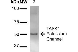 Western Blot analysis of Rat Brain Membrane showing detection of ~50 kDa TASK1 Potassium Channel protein using Mouse Anti-TASK1 Potassium Channel Monoclonal Antibody, Clone S374-48 .