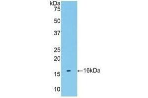 Detection of Recombinant TMEM27, Human using Polyclonal Antibody to Transmembrane Protein 27 (TMEM27) (TMEM27 antibody  (AA 17-137))