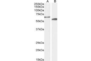 ABIN6391375 (2µg/ml) staining of Mouse (A) and Rat (B) Testes lysate (35µg protein in RIPA buffer). (CYP2R1 antibody  (AA 405-418))