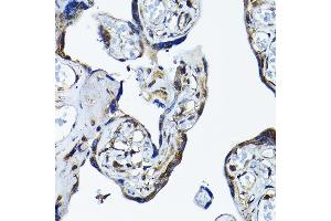 Immunohistochemistry (IHC) image for anti-Protein Arginine Methyltransferase 5 (PRMT5) (AA 40-140) antibody (ABIN3022066)