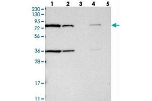 Western blot analysis of Lane 1: RT-4, Lane 2: U-251 MG, Lane 3: Human Plasma, Lane 4: Liver, Lane 5: Tonsil with HSD17B4 polyclonal antibody  at 1:250-1:500 dilution. (HSD17B4 antibody)