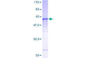 Image no. 1 for Natural Cytotoxicity Triggering Receptor 1 (NCR1) (AA 22-303) protein (GST tag) (ABIN1312142) (NCR1 Protein (AA 22-303) (GST tag))