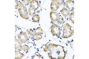 Immunohistochemistry of paraffin-embedded human stomach using RBP2 antibody (ABIN5974059) at dilution of 1/100 (40x lens). (RBP2 antibody)