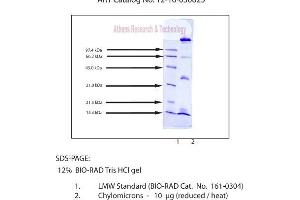 Gel Scan of Chylomicrons, Human Plasma  This information is representative of the product ART prepares, but is not lot specific.