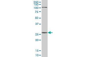 Western Blotting (WB) image for anti-Cathepsin D (CTSD) (AA 1-412) antibody (ABIN514770)