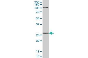 CTSD MaxPab polyclonal antibody. (Cathepsin D antibody  (AA 1-412))