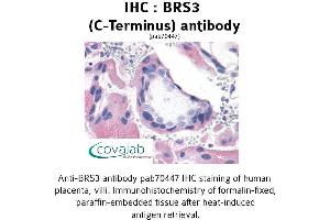Image no. 1 for anti-Bombesin-Like Receptor 3 (BRS3) (C-Term) antibody (ABIN1732417) (BRS3 antibody  (C-Term))