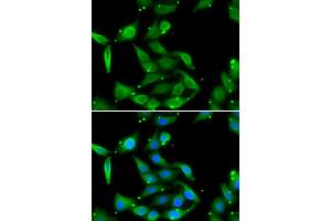 Immunofluorescence analysis of U2OS cells using GAMT antibody (ABIN5973964). (GAMT antibody)