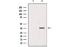 Western blot analysis of extracts from 293, using RALY Antibody. (Raly antibody  (Internal Region))