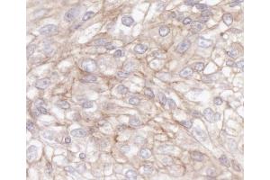 Immunohistochemistry (IHC) image for anti-IQ Motif Containing GTPase Activating Protein 1 (IQGAP1) (AA 1-50) antibody (ABIN7453634) (IQGAP1 antibody  (AA 1-50))