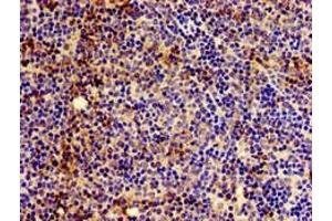 Immunohistochemistry of paraffin-embedded human lymph node tissue using ABIN7155567 at dilution of 1:100 (HLA-C antibody  (AA 200-306))