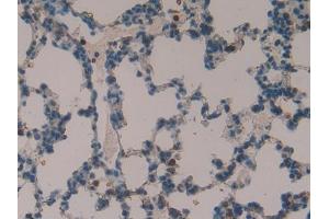 DAB staining on IHC-P; Samples: Rat Lung Tissue (TOR2A antibody  (AA 34-293))