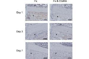 Immunostaining of IL-6 on day 1, 3 and 7 in tissue sections of control animals (Fx) and after administration of C5aRA (Fx & C5aRA) showing the callus region in detail (fracture gap on the left, cortex in the middle, bone marrow on top (*) and periosteal callus (#) on the bottom of the image. (IL-6 antibody  (AA 101-150))