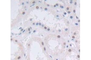 Used in DAB staining on fromalin fixed paraffin- embedded Kidney tissue (Achaete Scute Complex Like Protein 1 (AA 84-236) antibody)
