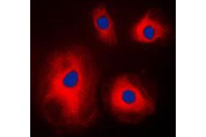 Immunofluorescent analysis of RPS4X staining in A431 cells. (RPS4X antibody  (Center))