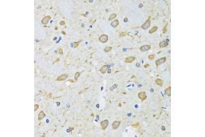 Immunohistochemistry of paraffin-embedded mouse brain using ATG7 antibody. (ATG7 antibody)