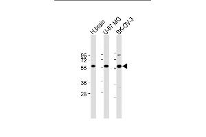 All lanes : Anti-DYNC1LI2 Antibody (Center) at 1:2000 dilution Lane 1: Human brain lysate Lane 2: U-87 MG whole cell lysate Lane 3: SK-OV-3 whole cell lysate Lysates/proteins at 20 μg per lane. (DYNC1LI2 antibody  (AA 152-180))