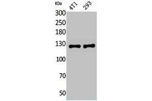 Western Blot analysis of 4T1, 293 cells using Integrin αD Polyclonal Antibody. (ITGAD antibody  (Internal Region))